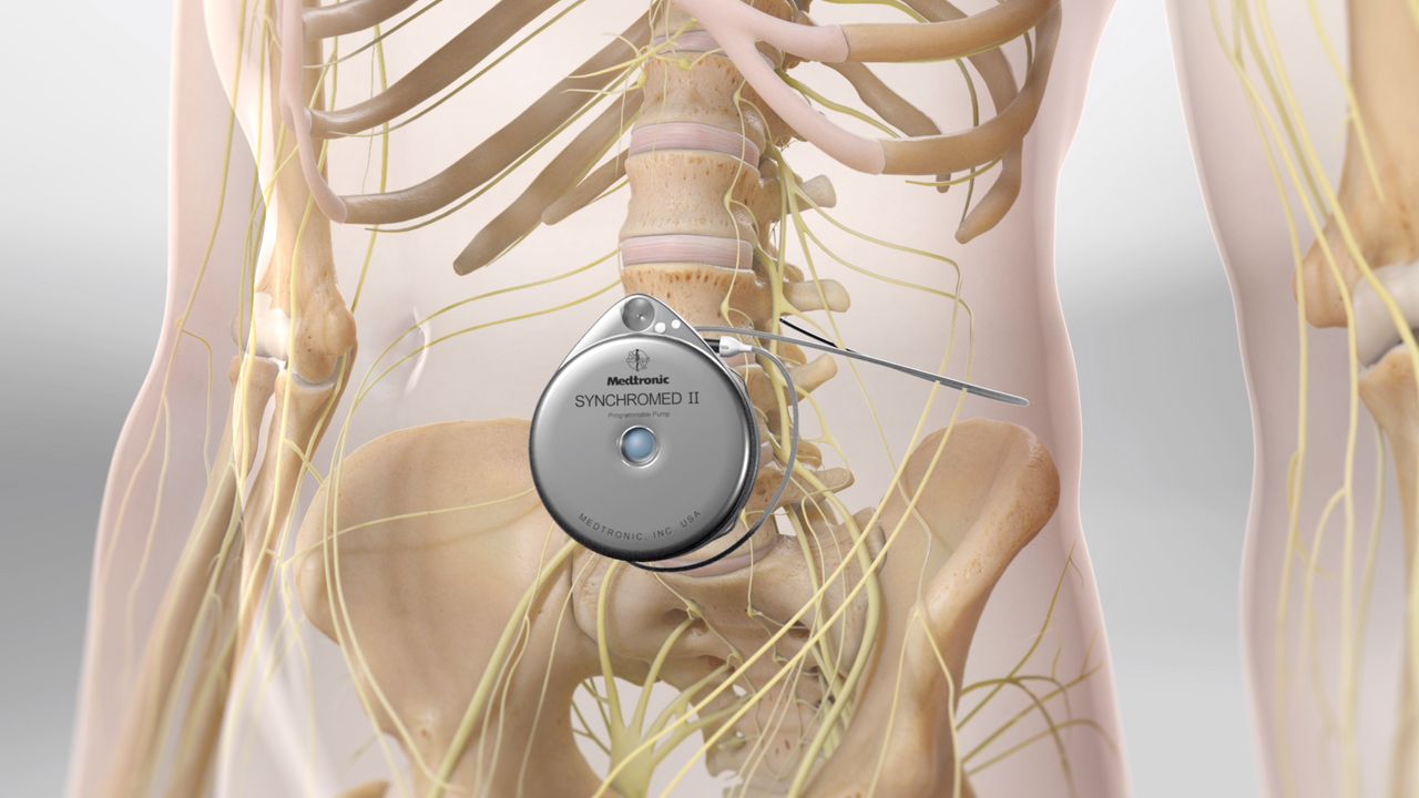 Is Intrathecal Administration Safe?